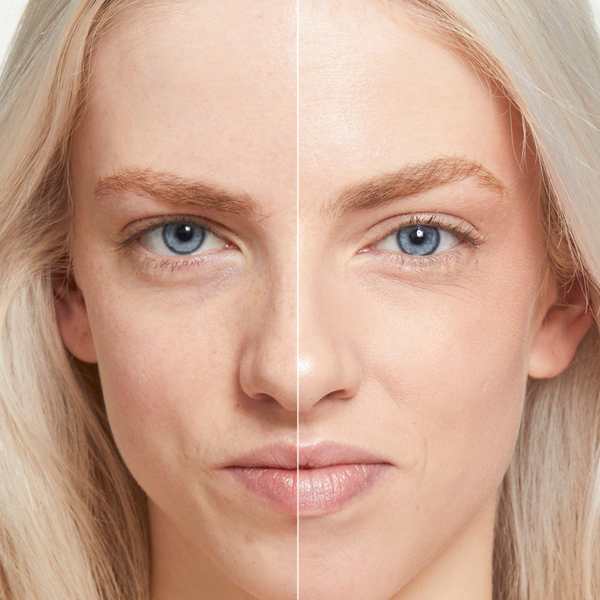 Fold Out Complexion® Kit